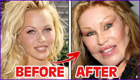 10 Celebrities Who Have Talked About Getting Plastic Surgery
